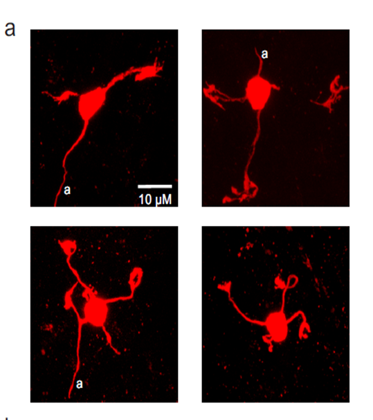 Granule cells in the ELL of mormyrid fish