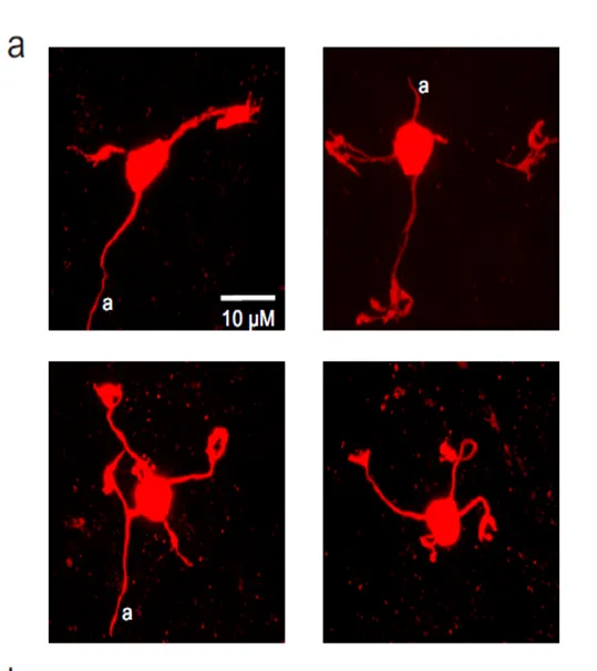 Granule cells labelled with dextran in mormyrid ELL.